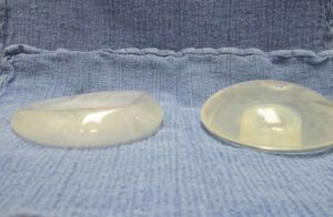 my saline breast implant deflated - now what - what do I do?