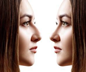 what does a nose job cost? many factors go into the price