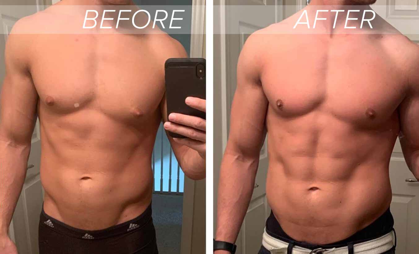man taking before and after photo selfies showing results from gynecomastia surgery