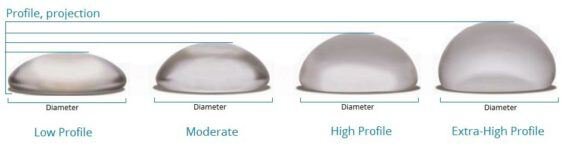 compare breast implant sizes - low profile high profile moderate extra high