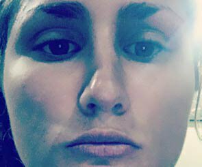 break your nose after a nose job