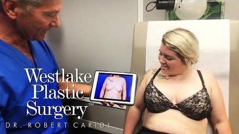 Breast Lift with Implants Surgery Before and After
