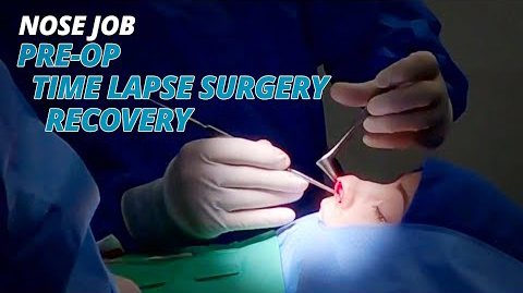 Complete Nose Job -> Pre-Op Consultation -> Time Lapse Surgery -> Recovery