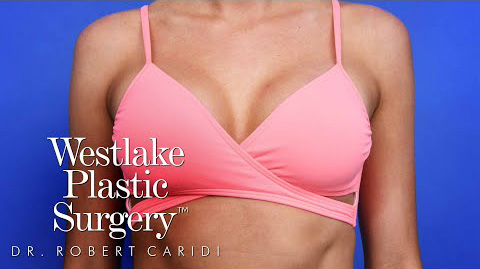 How To Get Natural Looking Results From A Breast Augmentation