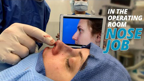 Nose Job Surgery Footage (IN THE OPERATING ROOM)