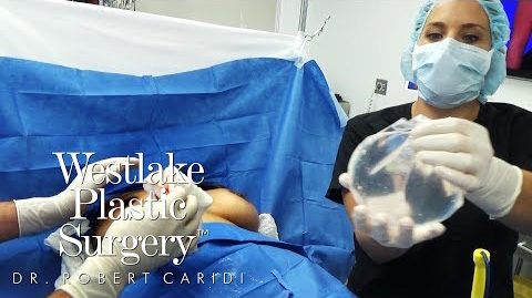 Saline Breast Implant Removal Surgery Using Local Anesthesia